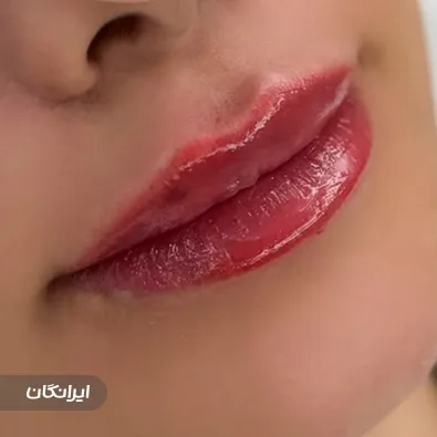 کلینیک زیبایی آرون