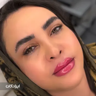 کلینیک زیبایی آرون