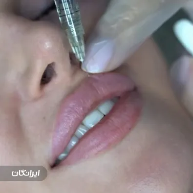 کلینیک زیبایی مهر