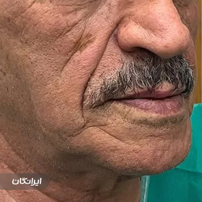 کلینیک زیبایی مهنو