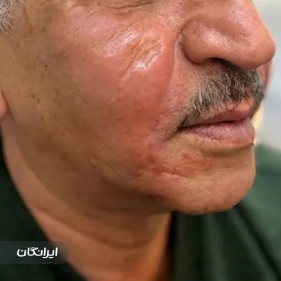 کلینیک زیبایی مهنو