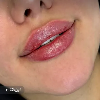 کلینیک زیبایی دکتر نسترن تاج آبادی