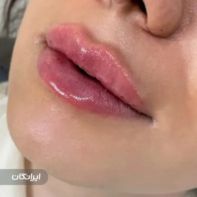 کلینیک زیبایی دکتر نسترن تاج آبادی