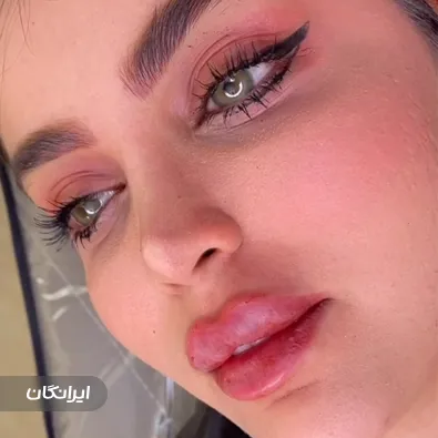 کلینیک زیبایی درمیس