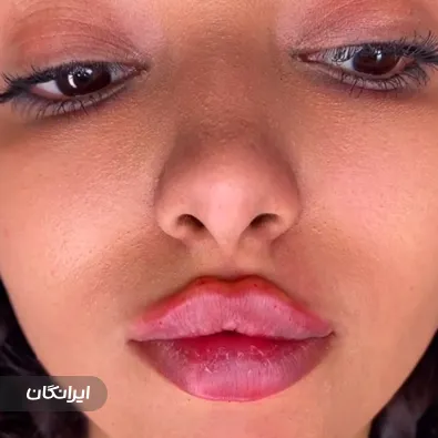 کلینیک زیبایی درمیس