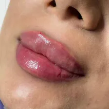 مرکز درمان زخم دکتر قره لی