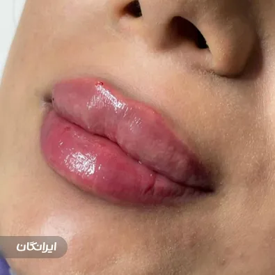 مرکز درمان زخم دکتر قره لی