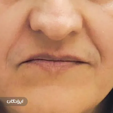 مرکز درمان زخم دکتر قره لی