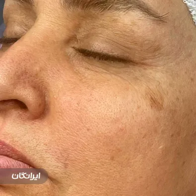 سالن خدمات پوستی هانیه