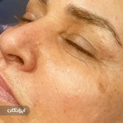 سالن خدمات پوستی هانیه