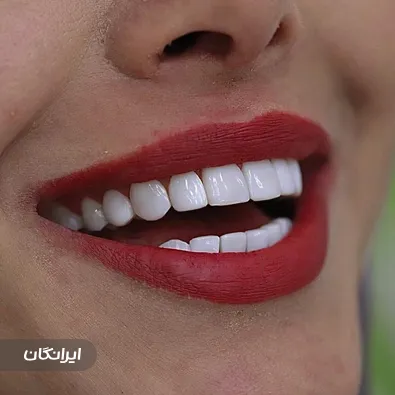 دندانپزشکی هیوا