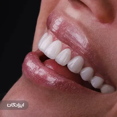 دندانپزشکی هیوا