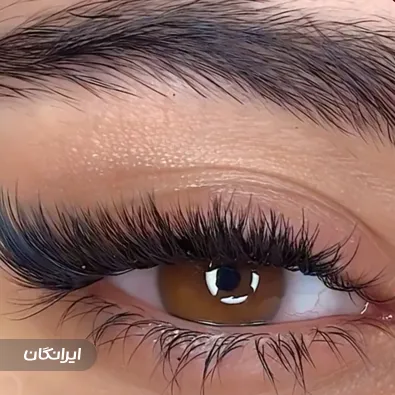 کاشت مژه ماهین باباخانی