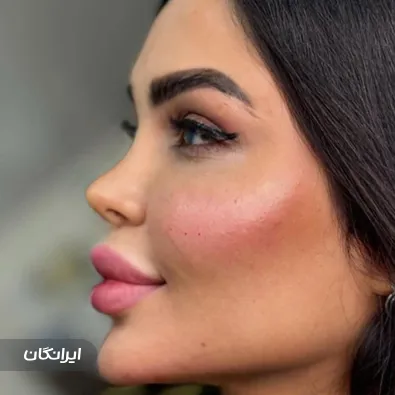 کلینیک زیبایی مانیا