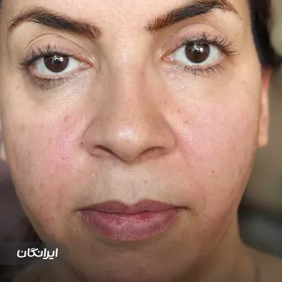 کلینیک زیبایی لیان