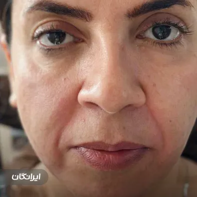 کلینیک زیبایی لیان