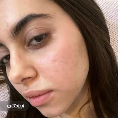 سالن مراقبت پوستی شیرین