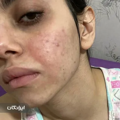 سالن مراقبت پوستی شیرین