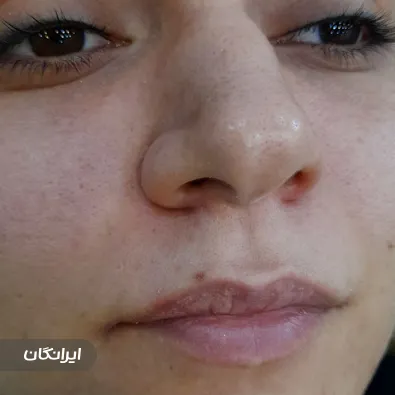 فیشیال و پاکسازی ابوترابی