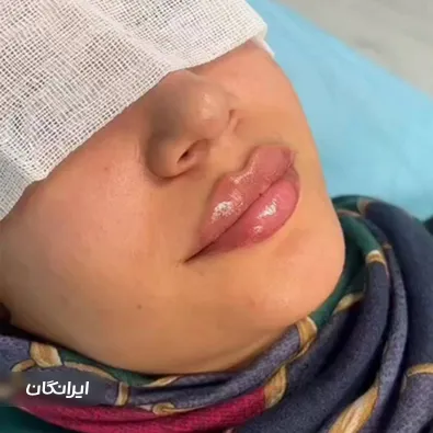 کلینیک زیبایی بیتا بیوتی