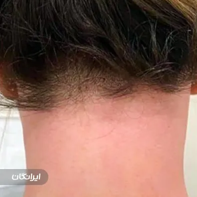 کلینیک لیزر لاویتا