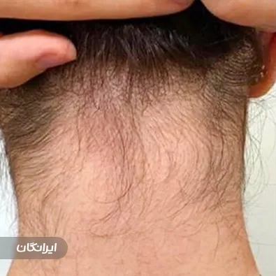 کلینیک لیزر لاویتا