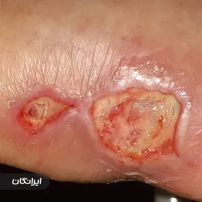 درمانگر زخم امیرمهدی نعمتی