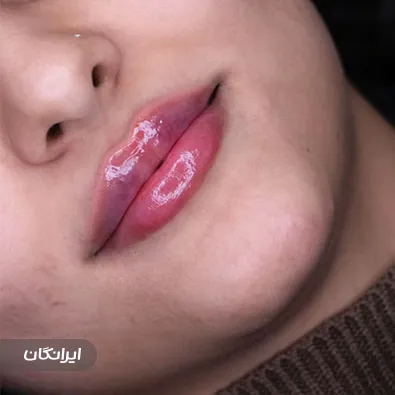 کلینیک زیبایی دکتر اعظم خانزاده