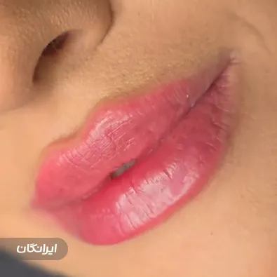 کلینیک زیبایی دكتر آزاده سعادتمند