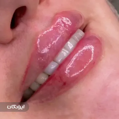 کلینیک زیبایی زرین ماه