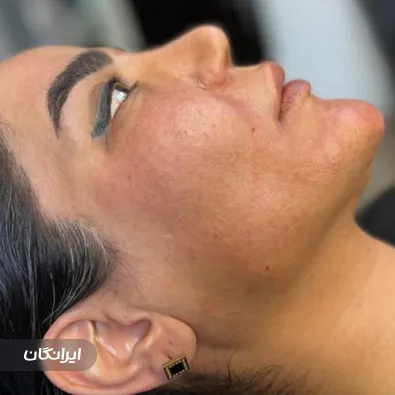 کلینیک زیبایی الیما