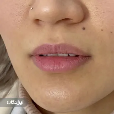 کلینیک زیبایی هیوا