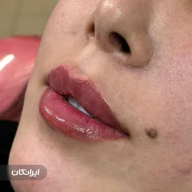 کلینیک زیبایی هیوا