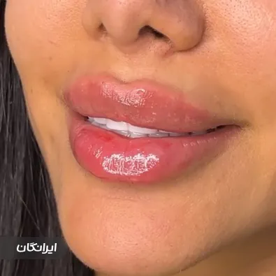 کلینیک زیبایی یلدا