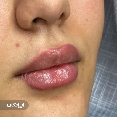 کلینیک زیبایی یلدا