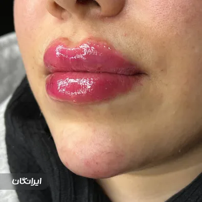 کلینیک زیبایی آتریسا