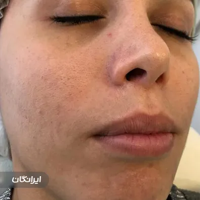 سالن پاکسازی پوست مرمر