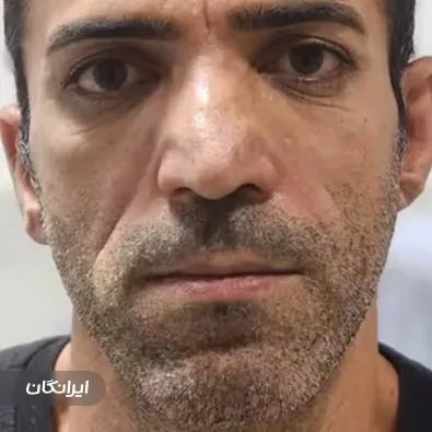 کلینیک زیبایی مهرآرا