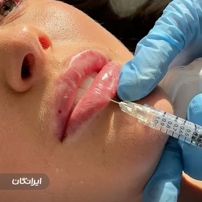 کلینیک زیبایی دکتر آمنه علیخانی