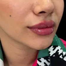 کلینیک زیبایی دکتر المیرا حسینی