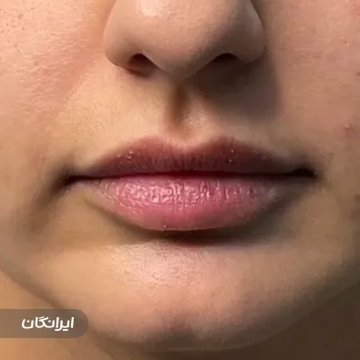 کلینیک زیبایی روکال