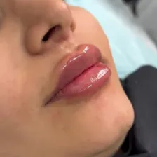 کلینیک زیبایی روکال