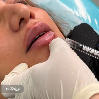 کلینیک زیبایی روکال