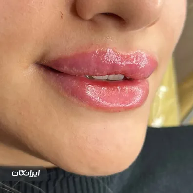 کلینیک زیبایی پر