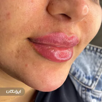 کلینیک زیبایی پر