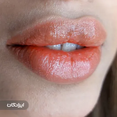 کلینیک زیبایی پر