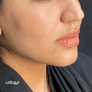 کلینیک زیبایی لاگوم