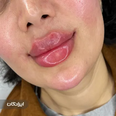 کلینیک زیبایی دکتر شیوا نیک پی