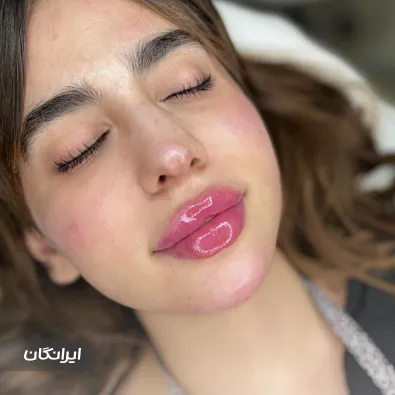 کلینیک زیبایی دکتر شیوا نیک پی