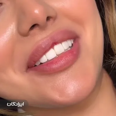 کلینیک زیبایی نیکا